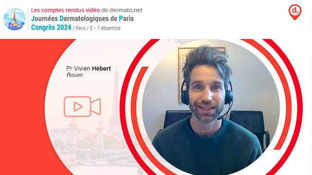 video, interview, imedia