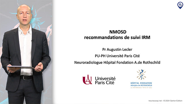 video, interview, imedia